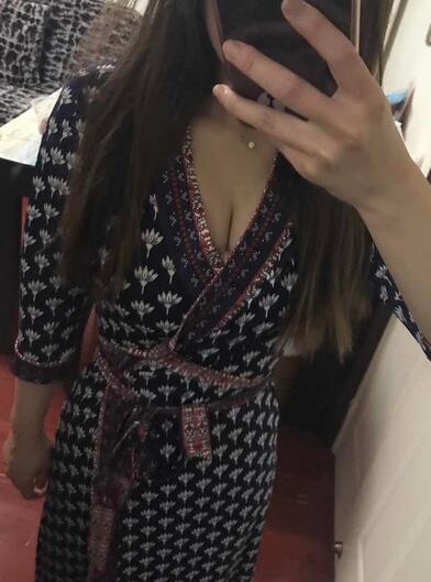 自體脂肪豐胸之后多久能上班 北京麗星豐胸恢復紀實