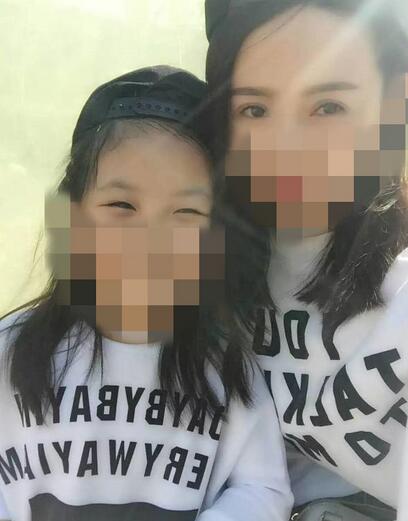 北京麗星雙眼皮修復(fù)半年了