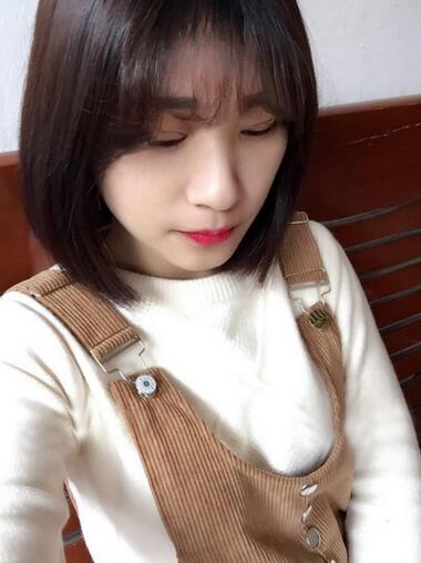 微創(chuàng)定點(diǎn)每天恢復(fù)過程圖 北京麗星雙眼皮3個(gè)月