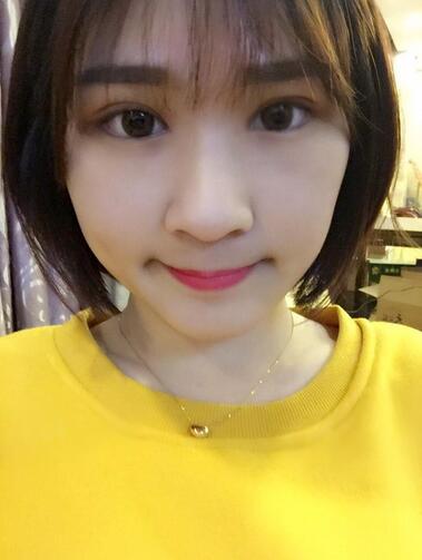 微創(chuàng)定點(diǎn)每天恢復(fù)過程圖 北京麗星雙眼皮3個(gè)月