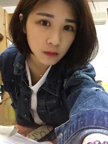 微創(chuàng)定點(diǎn)每天恢復(fù)過程圖 北京麗星雙眼皮3個(gè)月