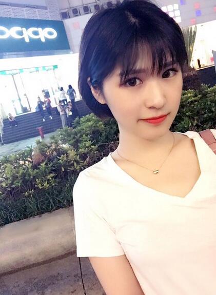 微創(chuàng)定點(diǎn)每天恢復(fù)過程圖 北京麗星雙眼皮3個(gè)月