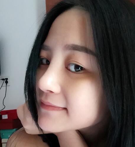 硅膠隆鼻前后對比 硅膠隆鼻+鼻小柱延長恢復日記