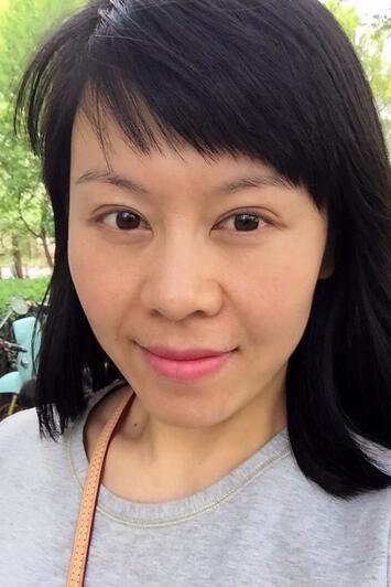 面部埋埋蛋白線.提升恢復(fù)過程分享