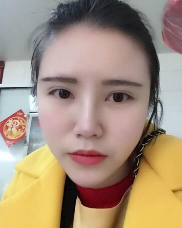 耳軟骨墊鼻尖一個月圖