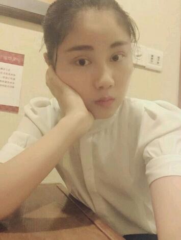 全切雙眼皮半年恢復(fù)過程圖