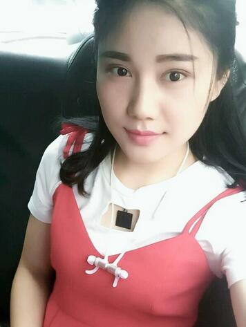 全切雙眼皮半年恢復(fù)過程圖