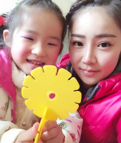 耳軟骨墊鼻尖三個(gè)月圖 耳軟骨墊鼻尖+硅膠隆鼻