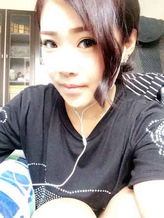 耳軟骨墊鼻尖三個(gè)月圖 耳軟骨墊鼻尖+硅膠隆鼻