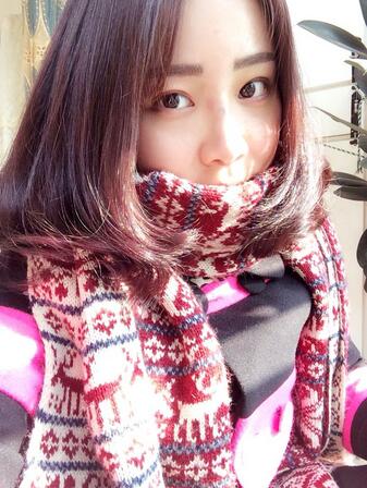 耳軟骨墊鼻尖三個(gè)月圖 耳軟骨墊鼻尖+硅膠隆鼻