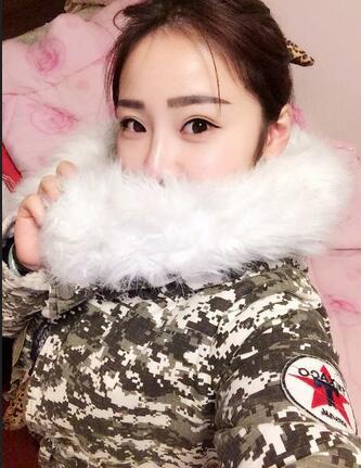 耳軟骨墊鼻尖三個(gè)月圖 耳軟骨墊鼻尖+硅膠隆鼻