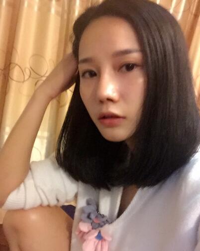 隆鼻整形真實(shí)恢經(jīng)歷 曬圖啦！