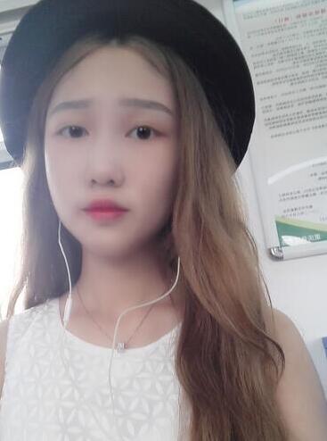 成都蜀尚蓉雅割雙眼皮+開眼角真實案例