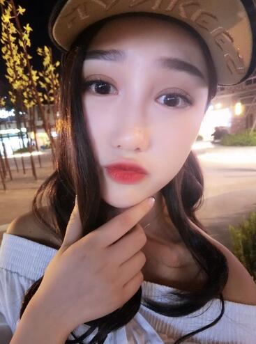 成都蜀尚蓉雅割雙眼皮+開眼角真實案例