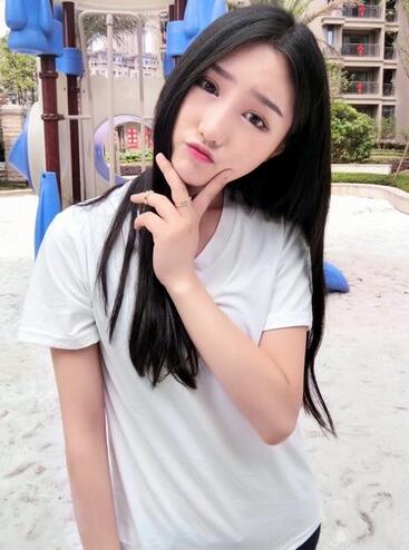 成都蜀尚蓉雅割雙眼皮+開眼角真實案例