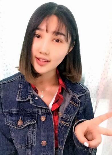 成都蜀尚蓉雅割雙眼皮+開眼角真實案例