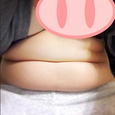 武漢茜韻腰腹環(huán)吸親身經(jīng)歷