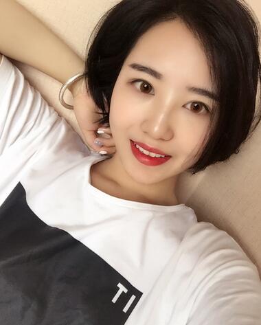 武漢憶美凱德去眼袋手術(shù)后兩個(gè)月照片