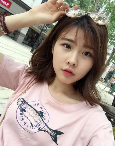 武漢西嬋康美玻尿酸隆鼻恢復(fù)過(guò)程圖