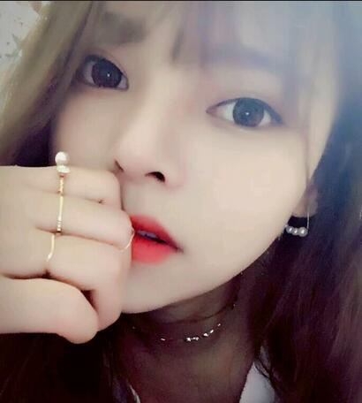 隆鼻整形真實恢復(fù)期圖片 杭州東方隆鼻整形四個月