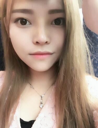 隆鼻整形真實恢復(fù)期圖片 杭州東方隆鼻整形四個月