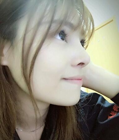 隆鼻整形真實恢復(fù)期圖片 杭州東方隆鼻整形四個月