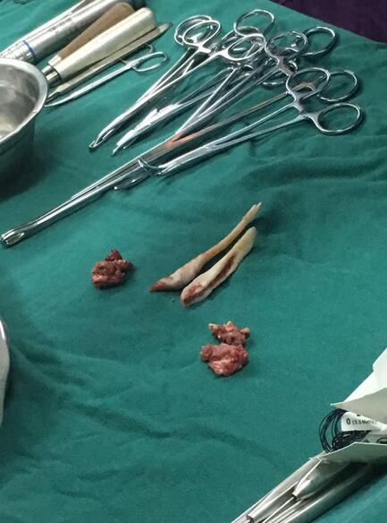 北京八大處張智勇V-line瓜子臉手術(shù)前后對比