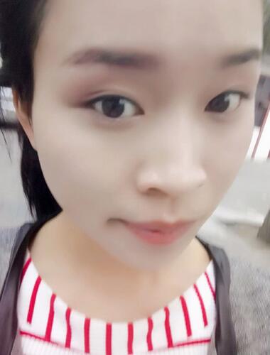 北京八大處張智勇V-line瓜子臉手術(shù)前后對比