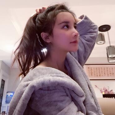 發(fā)際線調(diào)整果對比圖 杭州大麥微針龍都發(fā)際線種植