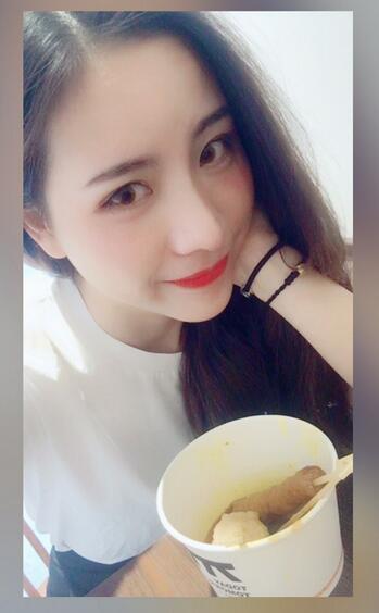 北京藝星王英勇隆鼻案例 隆鼻整形三個月