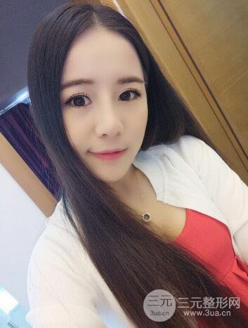 假體隆鼻恢復(fù)過程實(shí)例 前后果對(duì)比