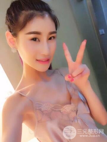 曼托假體+自體脂肪豐胸前后對比 重慶軍美打造果凍胸