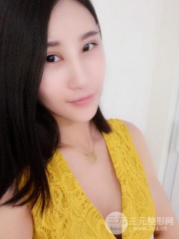 曼托假體+自體脂肪豐胸前后對比 重慶軍美打造果凍胸