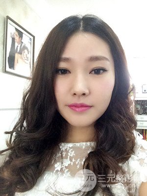 南昌永康整形打水光補水果圖前后對比