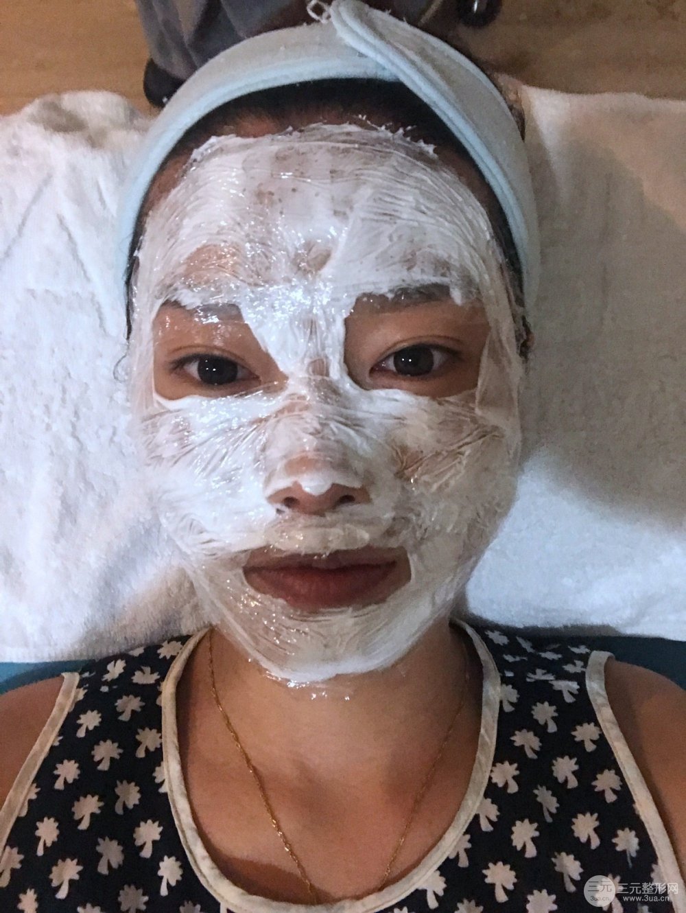 南昌永康整形打水光補水果圖前后對比