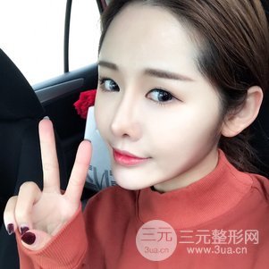 南京米尚恩陳天杰自體脂肪填充全臉 女神的養(yǎng)成記！