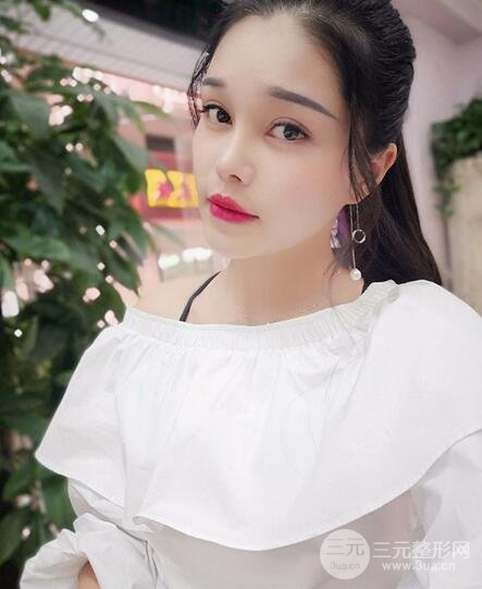 鼻頭縮小術(shù)過(guò)程圖，鼻頭縮小恢復(fù)日記