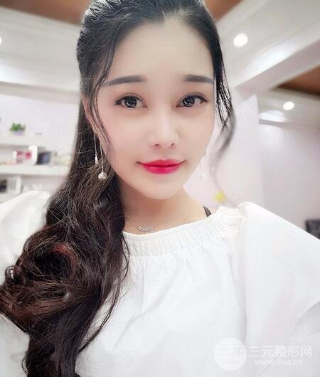 鼻頭縮小術(shù)過(guò)程圖，鼻頭縮小恢復(fù)日記