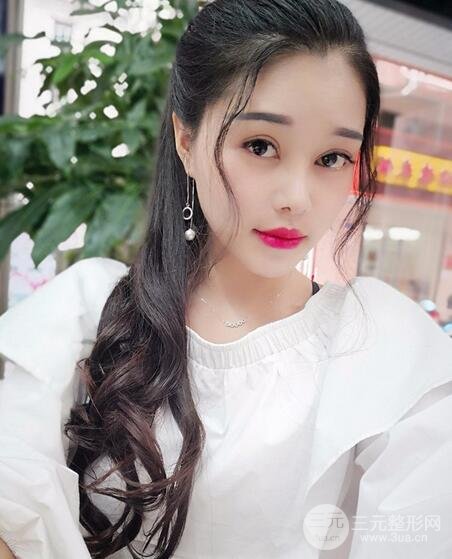 鼻頭縮小術(shù)過(guò)程圖，鼻頭縮小恢復(fù)日記