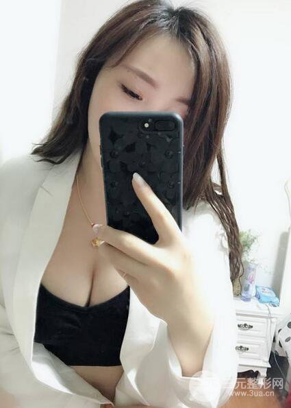 自體脂肪豐胸3個月分享，活細胞豐胸術(shù)后果逼真更自然