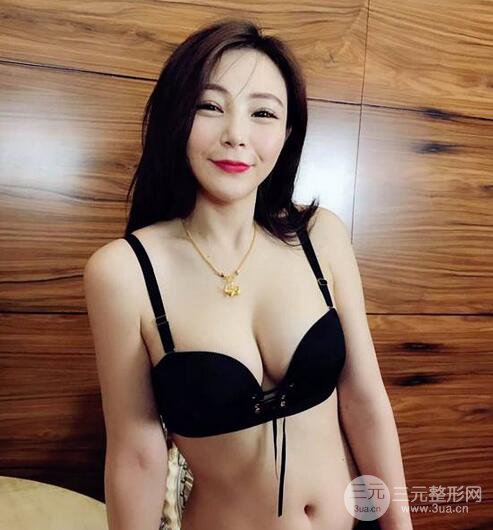 自體脂肪豐胸3個月分享，活細胞豐胸術(shù)后果逼真更自然