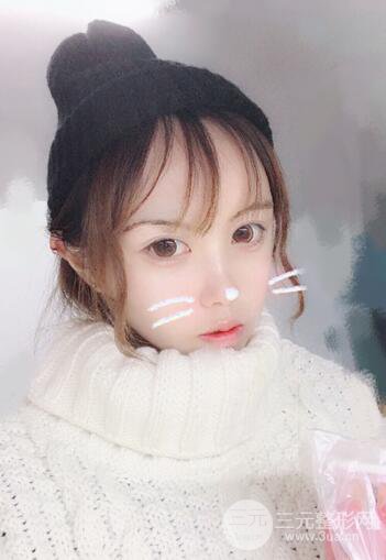 自體脂肪填充全臉基本換臉,改臉型不只是磨骨才能做到!