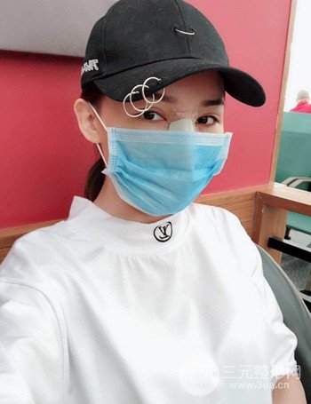 上海隆鼻失敗手術(shù)修復(fù)果超乎想象、前后對(duì)比照片分享