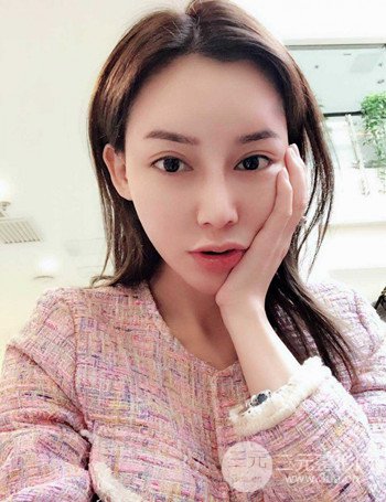 上海隆鼻失敗手術(shù)修復(fù)果超乎想象、前后對(duì)比照片分享