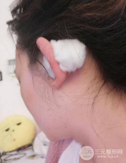 耳軟骨隆鼻全過(guò)程及術(shù)后果分享