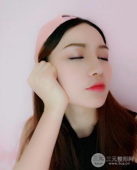 耳軟骨隆鼻全過(guò)程及術(shù)后果分享