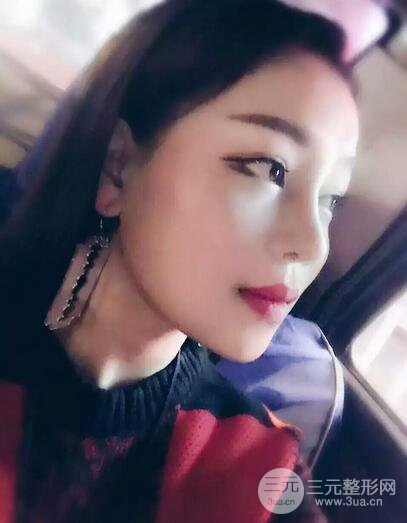 【下頜角+顴骨+下巴】全臉磨骨整形