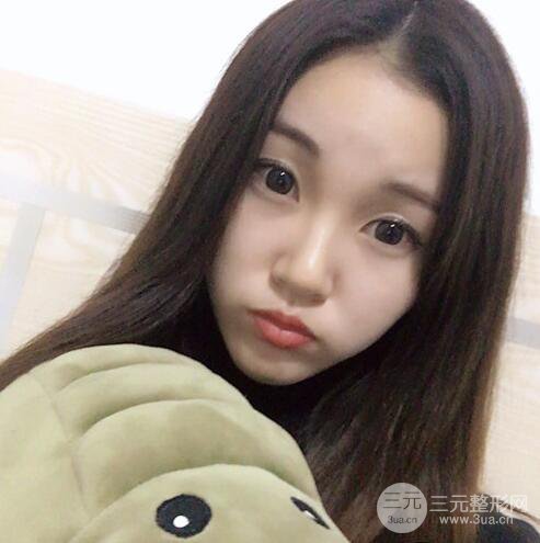 下頜角磨骨整形全過程分享，附上術(shù)后恢復(fù)照片~