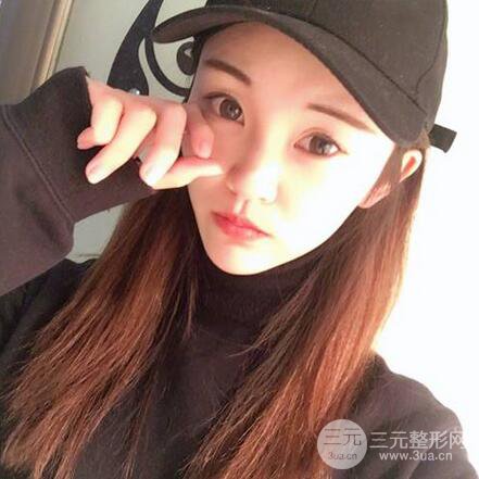 下頜角磨骨整形全過程分享，附上術(shù)后恢復(fù)照片~