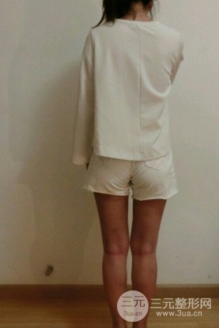 大腿抽脂果好到不行、瘦十厘米不是問題